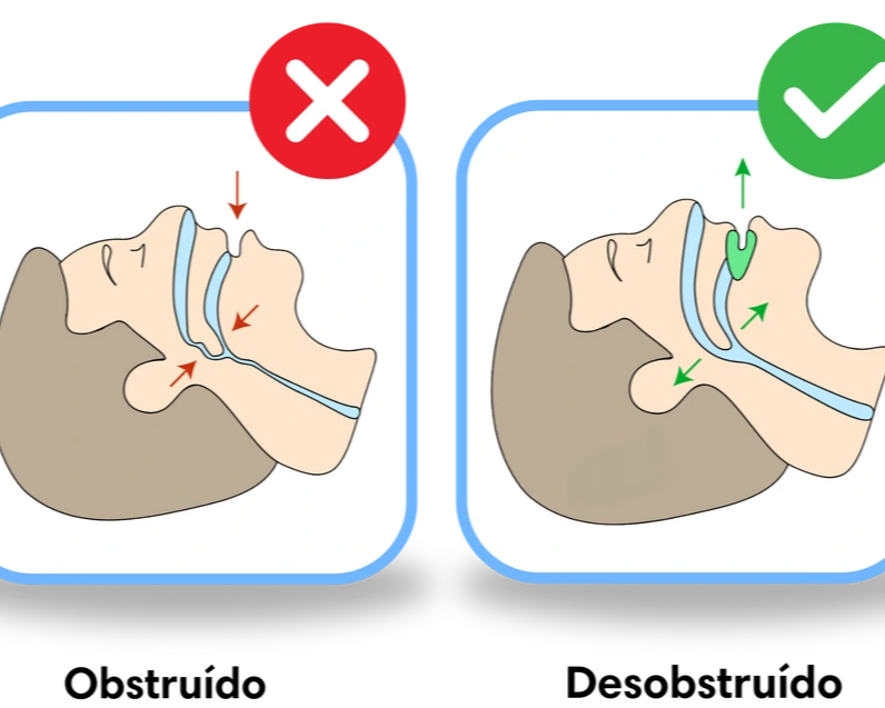 COPIAAAAA SILENT PRO ANTIRONQUIDO® #1 MÁS VENDIDO EN COLOMBIA + EBOOK GRATUITO 🇨🇴